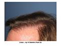 Click image for larger version

Name:	Slide6.JPG
Views:	506
Size:	74.6 KB
ID:	447357