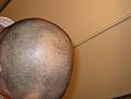 Click image for larger version

Name:	hair2 (2).JPG
Views:	499
Size:	93.2 KB
ID:	447388