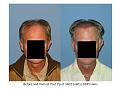 Click image for larger version

Name:	Slide1.JPG
Views:	448
Size:	55.8 KB
ID:	447616