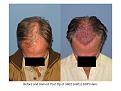 Click image for larger version

Name:	Slide3.JPG
Views:	452
Size:	66.0 KB
ID:	447618