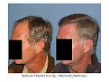 Click image for larger version

Name:	Slide6.JPG
Views:	428
Size:	69.6 KB
ID:	447621