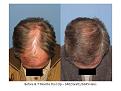 Click image for larger version

Name:	Slide7.JPG
Views:	425
Size:	80.7 KB
ID:	447622