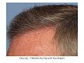 Click image for larger version

Name:	Slide14.jpg
Views:	389
Size:	81.4 KB
ID:	447629
