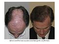 Click image for larger version

Name:	Slide2.JPG
Views:	449
Size:	62.3 KB
ID:	447884
