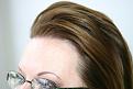 Click image for larger version

Name:	2010-0127    1 yr post op  ba 005.jpg
Views:	426
Size:	87.9 KB
ID:	447965