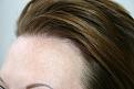 Click image for larger version

Name:	2010-0127    1 yr post op  ba 006.jpg
Views:	396
Size:	93.9 KB
ID:	447966