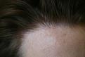 Click image for larger version

Name:	2010-0127    1 yr post op  ba 002.jpg
Views:	1103
Size:	82.1 KB
ID:	448022