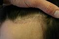 Click image for larger version

Name:	Date- (2009-0211)    Notes- 1 months 002.jpg GOF.jpg
Views:	382
Size:	91.6 KB
ID:	448300