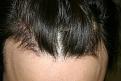 Click image for larger version

Name:	Date- (2009-0519)    Notes- post op  ba 003.jpg GOF.jpg
Views:	366
Size:	95.9 KB
ID:	448304