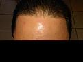 Click image for larger version

Name:	hairline.jpg
Views:	544
Size:	88.2 KB
ID:	448361