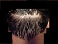 Click image for larger version

Name:	scar.jpg
Views:	656
Size:	81.2 KB
ID:	448362