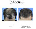 Click image for larger version

Name:	fullheaddown18m.jpg
Views:	439
Size:	82.2 KB
ID:	448404