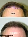 Click image for larger version

Name:	3.20.10 045.jpg
Views:	725
Size:	54.2 KB
ID:	448488