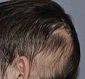 Click image for larger version

Name:	2r.jpg
Views:	1936
Size:	68.3 KB
ID:	448591