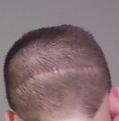 Click image for larger version

Name:	scar22.jpg
Views:	389
Size:	17.9 KB
ID:	448621