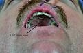 Click image for larger version

Name:	cleft-palate.jpg
Views:	728
Size:	89.7 KB
ID:	448719