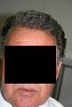 Click image for larger version

Name:	Date- (2010-0429)    Notes- 13 months post op 002.jpg
Views:	377
Size:	91.9 KB
ID:	448982