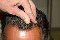 Click image for larger version

Name:	Date- (2010-0429)    Notes- 13 months post op 004.jpg
Views:	384
Size:	88.7 KB
ID:	449790