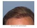 Click image for larger version

Name:	Slide4.JPG
Views:	485
Size:	59.6 KB
ID:	449853