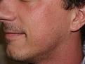 Click image for larger version

Name:	Alan Before L.jpg
Views:	1251
Size:	95.5 KB
ID:	449939