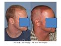 Click image for larger version

Name:	Slide2.JPG
Views:	566
Size:	64.0 KB
ID:	449976