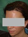 Click image for larger version

Name:	After side.JPG
Views:	407
Size:	54.4 KB
ID:	450162