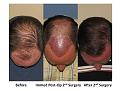 Click image for larger version

Name:	Slide5.JPG
Views:	795
Size:	72.1 KB
ID:	450181