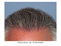 Click image for larger version

Name:	Slide9.JPG
Views:	392
Size:	89.0 KB
ID:	450449