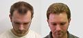 Click image for larger version

Name:	LY tp before and after.jpg
Views:	498
Size:	91.3 KB
ID:	450501