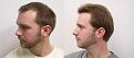 Click image for larger version

Name:	LY lft side before and after.jpg
Views:	500
Size:	93.2 KB
ID:	450502