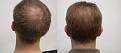 Click image for larger version

Name:	LY crown before and after.jpg
Views:	486
Size:	92.4 KB
ID:	450503