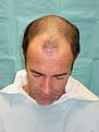 Click image for larger version

Name:	Pre-op 02.jpg
Views:	465
Size:	89.8 KB
ID:	450545