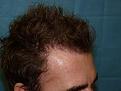 Click image for larger version

Name:	Post-op 06.jpg
Views:	501
Size:	95.7 KB
ID:	450552