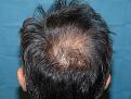 Click image for larger version

Name:	pre-op 04.jpg
Views:	380
Size:	97.4 KB
ID:	450567