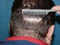 Click image for larger version

Name:	1 year post-op 015.jpg
Views:	429
Size:	97.2 KB
ID:	450669