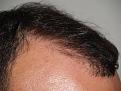 Click image for larger version

Name:	After Hairline.jpg
Views:	362
Size:	95.5 KB
ID:	450698