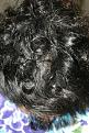 Click image for larger version

Name:	Date- (2010-0721)    Notes- 2 yrs post op  ba 003.jpg
Views:	463
Size:	101.9 KB
ID:	450752