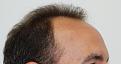 Click image for larger version

Name:	4 rightside before.jpg
Views:	316
Size:	79.7 KB
ID:	450786