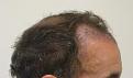 Click image for larger version

Name:	4a rightside 1 week after.jpg
Views:	321
Size:	66.9 KB
ID:	450787