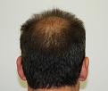 Click image for larger version

Name:	5 crown before.jpg
Views:	301
Size:	46.2 KB
ID:	450789