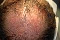Click image for larger version

Name:	5a Crown intraop.jpg
Views:	305
Size:	96.3 KB
ID:	450790