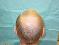 Click image for larger version

Name:	pre-op 03.jpg
Views:	543
Size:	90.7 KB
ID:	450801