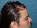 Click image for larger version

Name:	pre-op 01.jpg
Views:	413
Size:	96.0 KB
ID:	450907