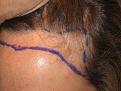 Click image for larger version

Name:	Before Hairline.jpg
Views:	384
Size:	48.9 KB
ID:	450937