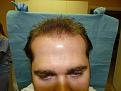 Click image for larger version

Name:	after surgery 01.jpg
Views:	431
Size:	88.2 KB
ID:	451124