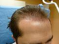 Click image for larger version

Name:	after surgery 04.jpg
Views:	435
Size:	91.5 KB
ID:	451127