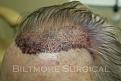 Click image for larger version

Name:	TC d immpo.jpg
Views:	415
Size:	22.9 KB
ID:	451166