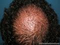 Click image for larger version

Name:	After Crown Closeup.JPG
Views:	481
Size:	96.9 KB
ID:	451215