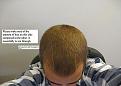 Click image for larger version

Name:	preop3.jpg
Views:	589
Size:	27.8 KB
ID:	451218