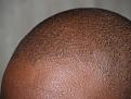 Click image for larger version

Name:	After Hairline.jpg
Views:	971
Size:	95.3 KB
ID:	451231
